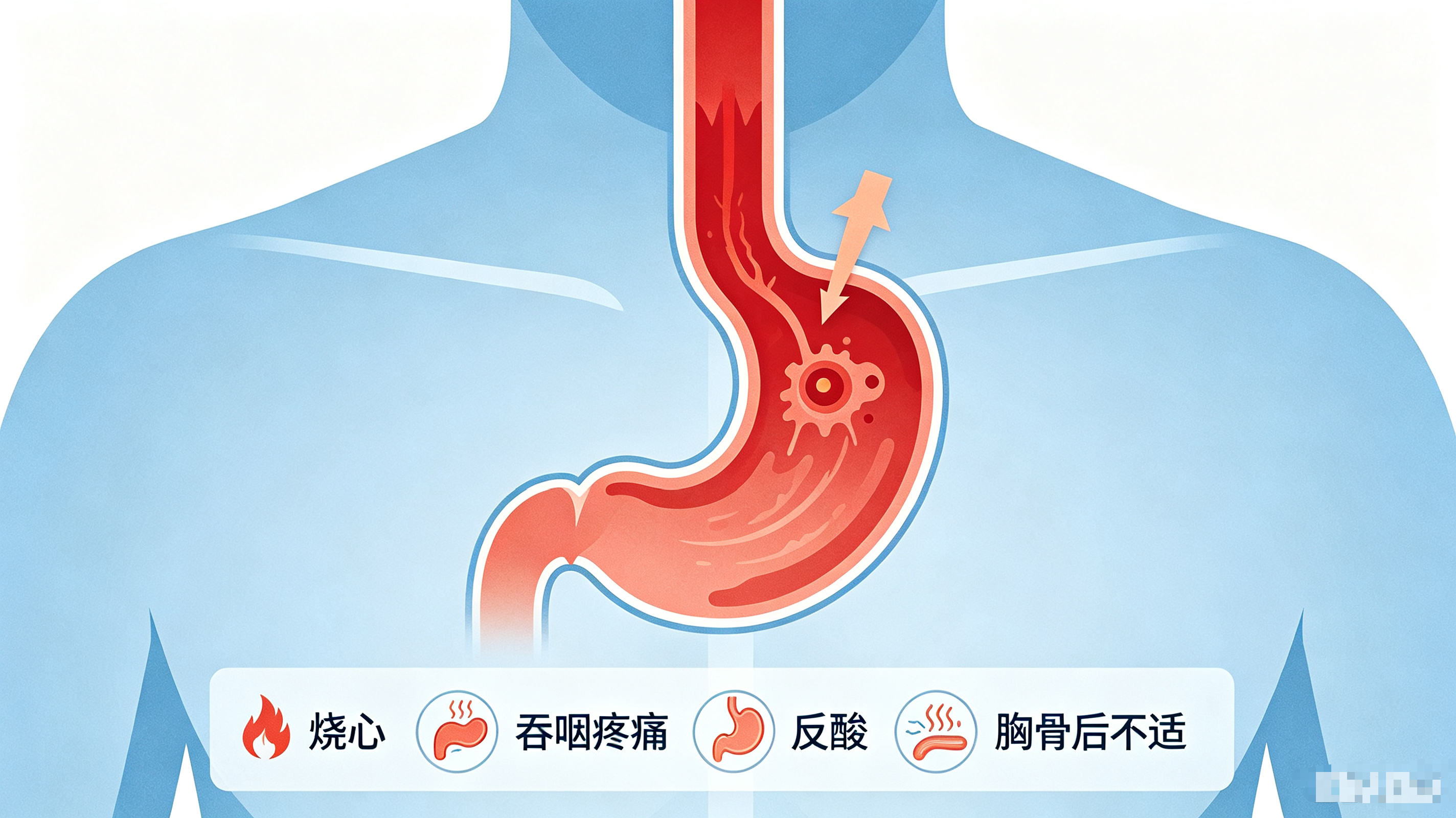 食管炎是什么疾病