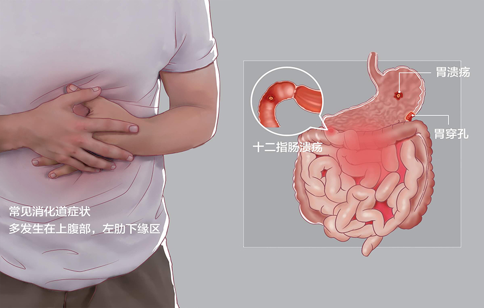 胃痛