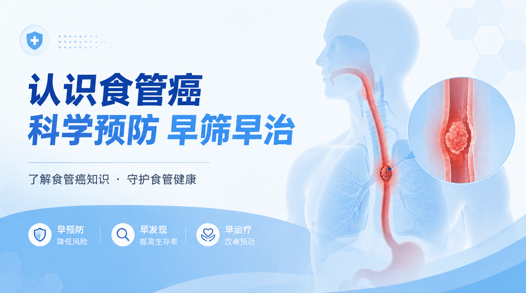 认识食管癌 科学预防